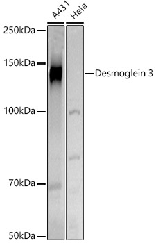 Western blot analysis of extracts of various cell lines using Desmoglein 3 Polyclonal Antibody at 1:500 dilution.