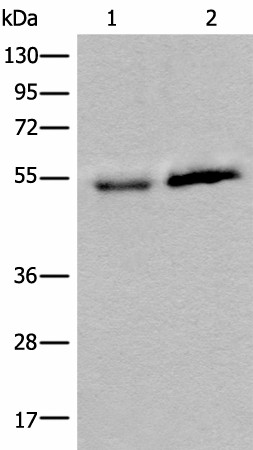 Western blot analysis of Human fetal intestines tissue and Human breast cancer tissue lysates  using CCDC85C Polyclonal Antibody at dilution of 1:400