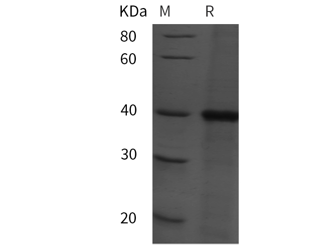 Recombinant Mouse TNF-α Protein(His Tag)-产品推荐-1
