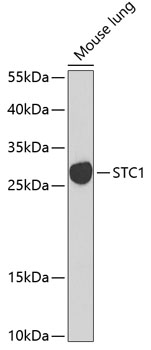 Western blot analysis of extracts of mouse lung using STC1 Polyclonal Antibody at 1:1000 dilution.