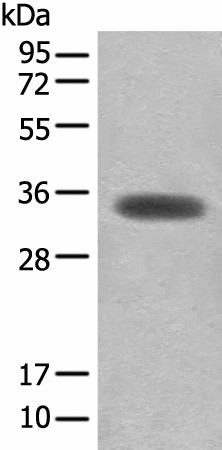 Western blot analysis of Mouse skeletal muscle tissue lysate  using MYOZ2 Polyclonal Antibody at dilution of 1:450