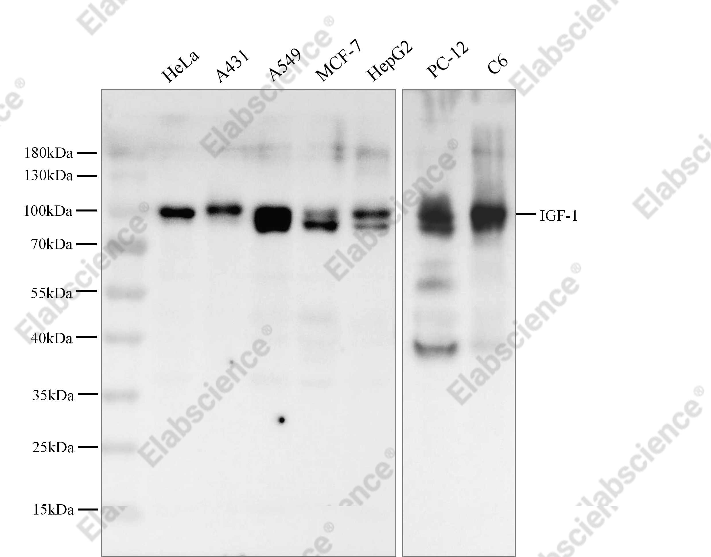 Recombinant IGF1R/CD221 Monoclonal Antibody - 1