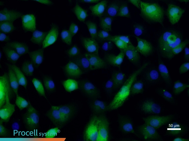 ACHN-GFP - 4