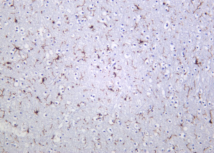 Recombinant Iba1 Monoclonal Antibody - small - 4