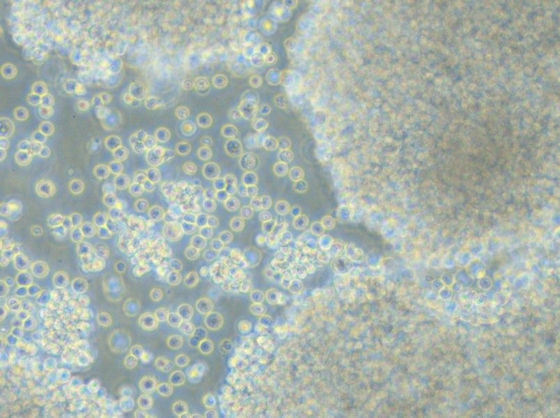 P3HR-1 Cell Complete Medium - small - 6