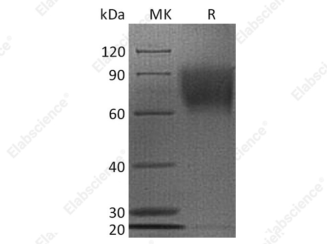 Recombinant Human CD30/TNFRSF8 Protein (His Tag) - 1