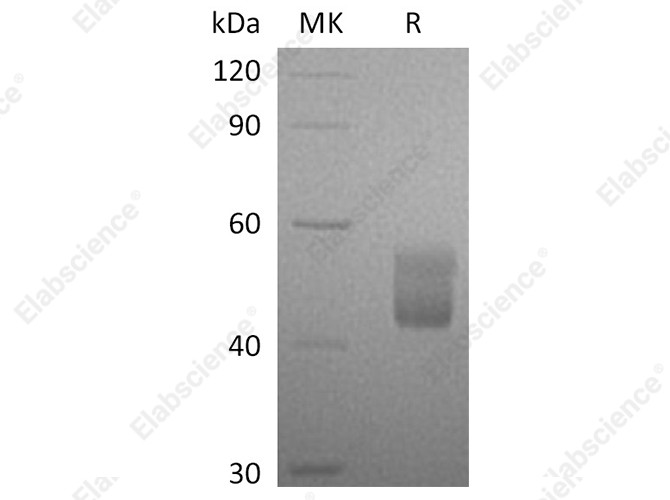 Recombinant Human CFHR3 Protein (His Tag) - 1