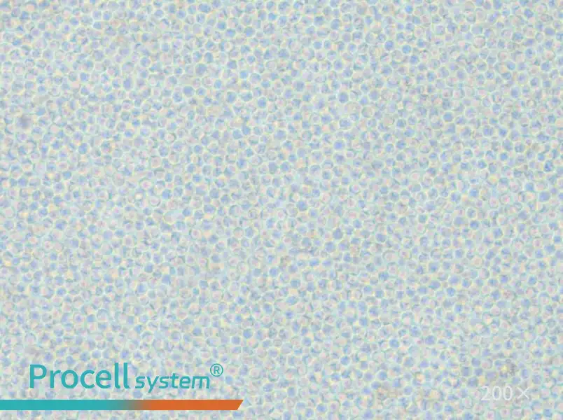 OCI-AML-2 Cell Complete Medium - 6