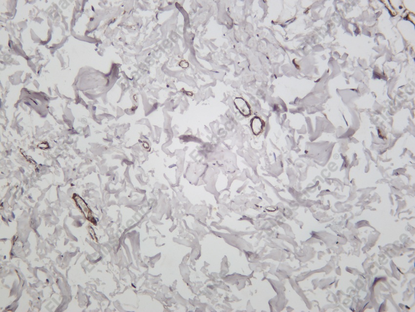 Recombinant α smooth muscle actin Monoclonal Antibody - 5