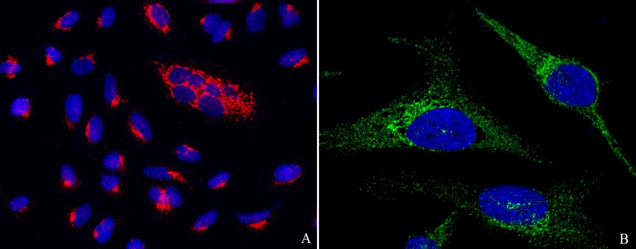 Recombinant PTP1B/PTPN1 Monoclonal Antibody-searchlist-1