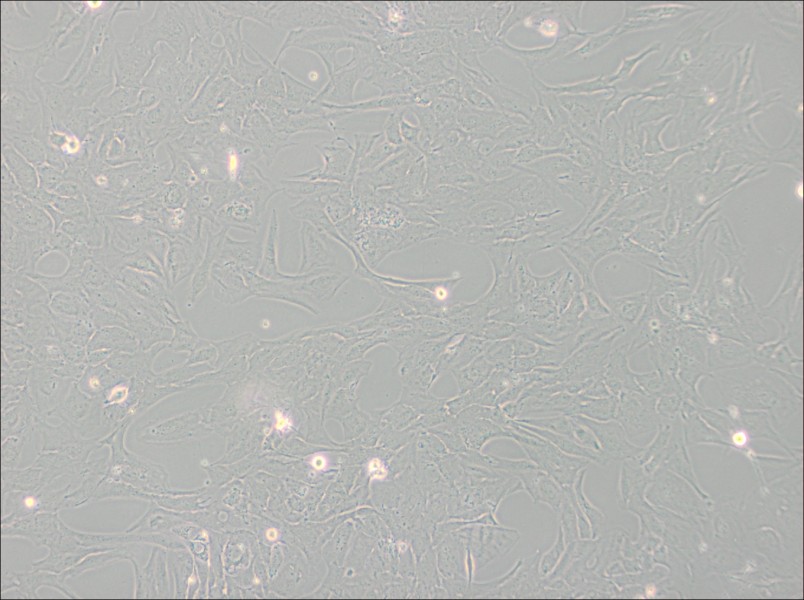 NCI-H196 Cell Complete Medium - 2
