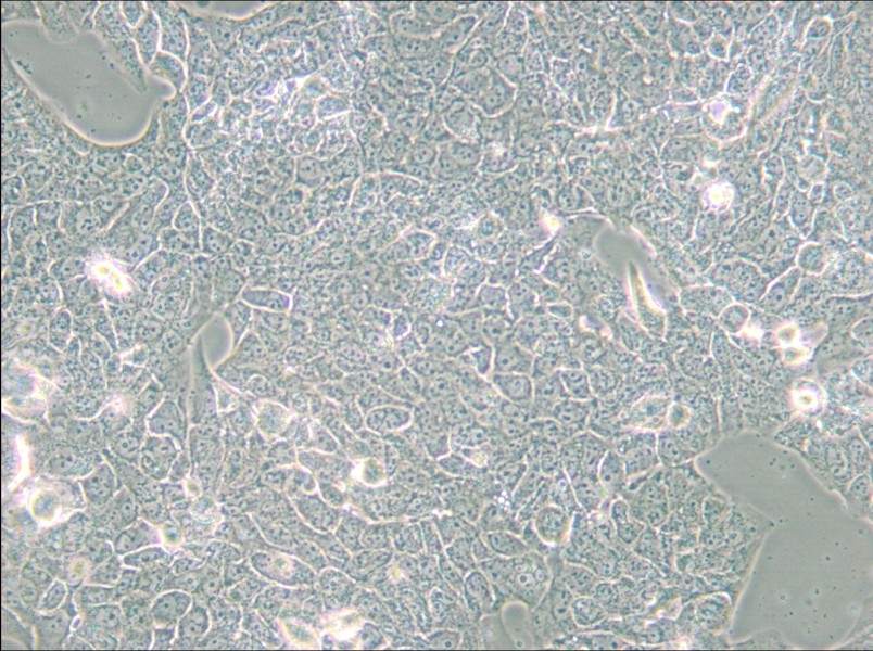 NCI-H2228 [H2228; H-2228] Cell Complete Medium - small - 6