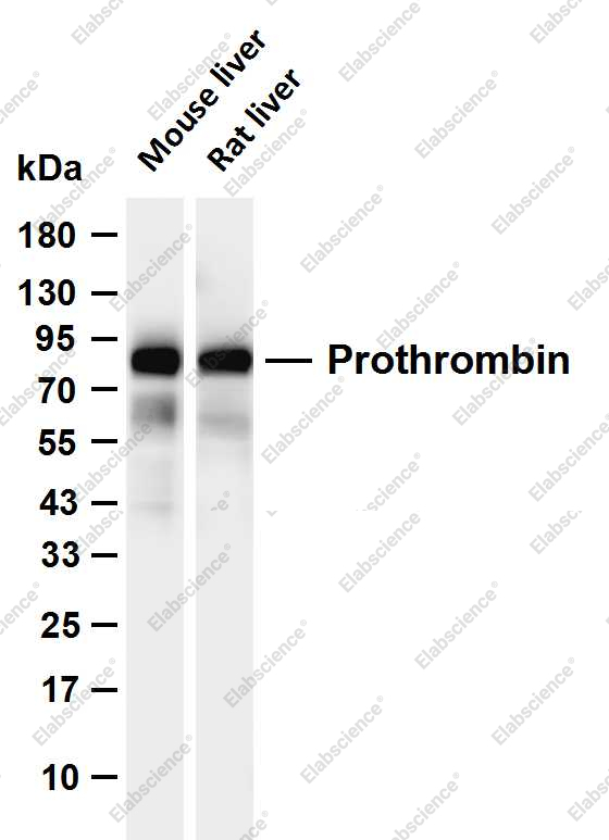 Recombinant Prothrombin Monoclonal Antibody - 1