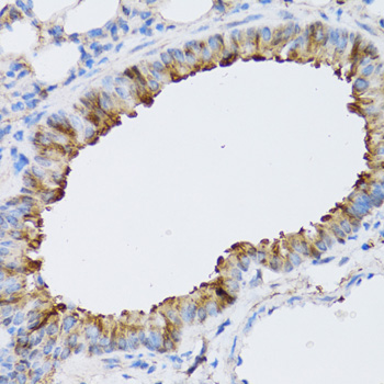 Immunohistochemistry of paraffin-embedded Mouse lung using NAA10 Polyclonal Antibody at dilution of 1:100 (40x lens).