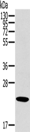 Western Blot analysis of Human liver cancer tissue using OTUB2 Polyclonal Antibody at dilution of 1:800