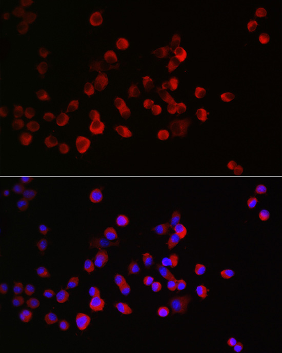 Immunofluorescence analysis of Neuro-2a cells using CRMP1 Polyclonal Antibody at dilution of 1:300 (40x lens). Blue: DAPI for nuclear staining.