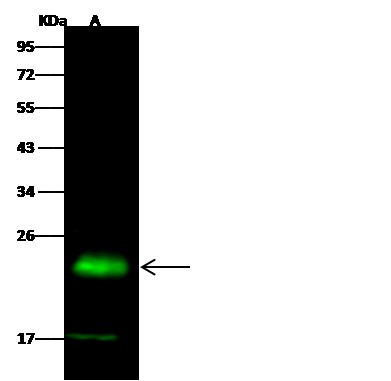 Recombinant PMVK/phosphomevalonate kinase Monoclonal Antibody - small - 2