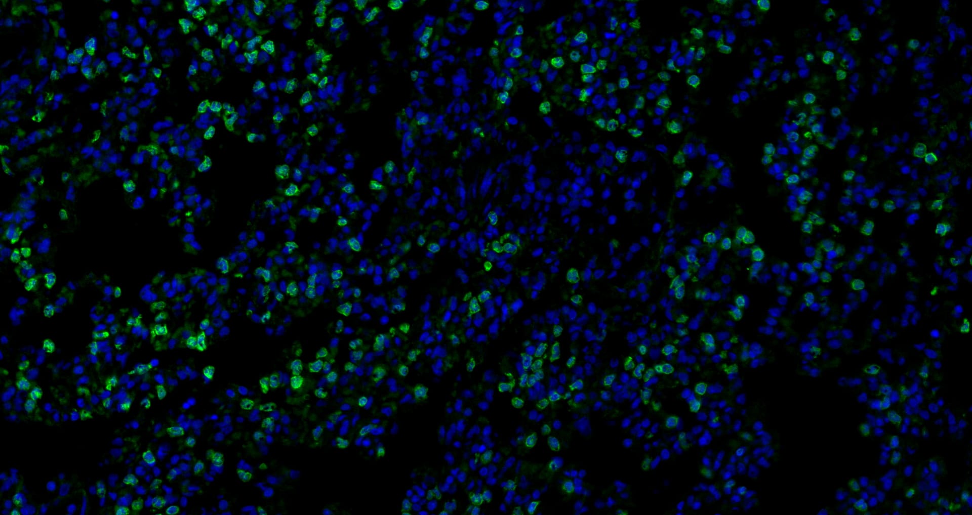 Immunofluorescence analysis of paraffin-embedded rat Inflammatory lung  using IL10 Polyclonal Antibody at dilution of 1:300.