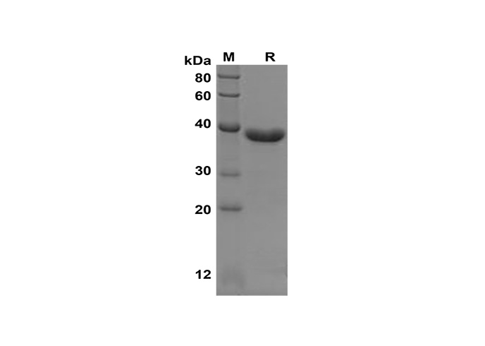 Recombinant Mouse Cd80 Protein(FC Tag)-产品推荐-1