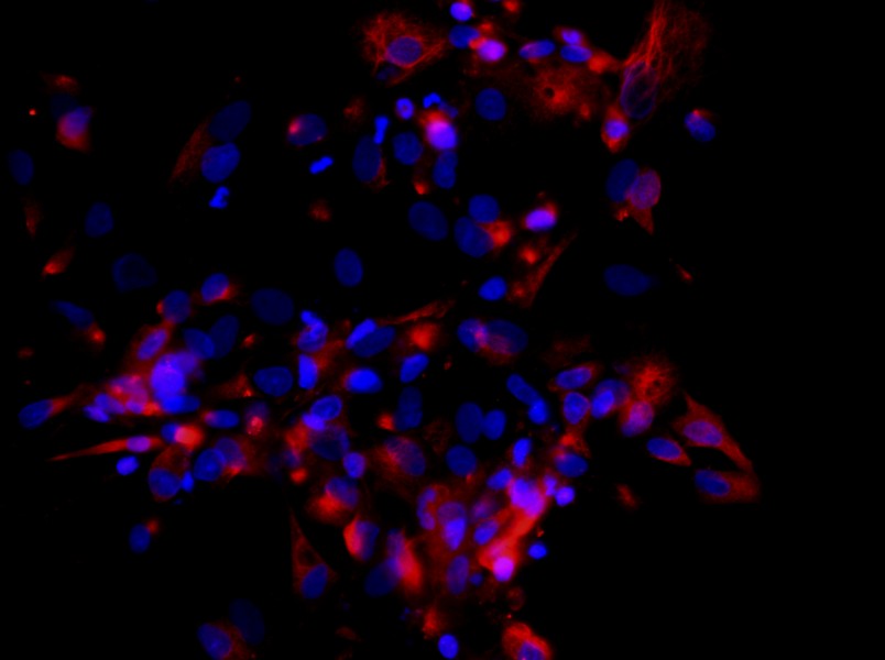 Mouse Extrahepatic Bile Duct Epithelial Cell Complete Medium - 2