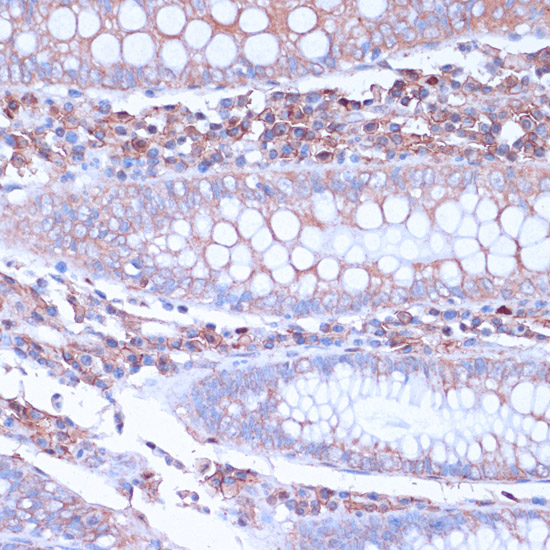 Immunohistochemistry of paraffin-embedded Human colon using CD38 Polyclonal Antibody at dilution of  1:100 (40x lens).