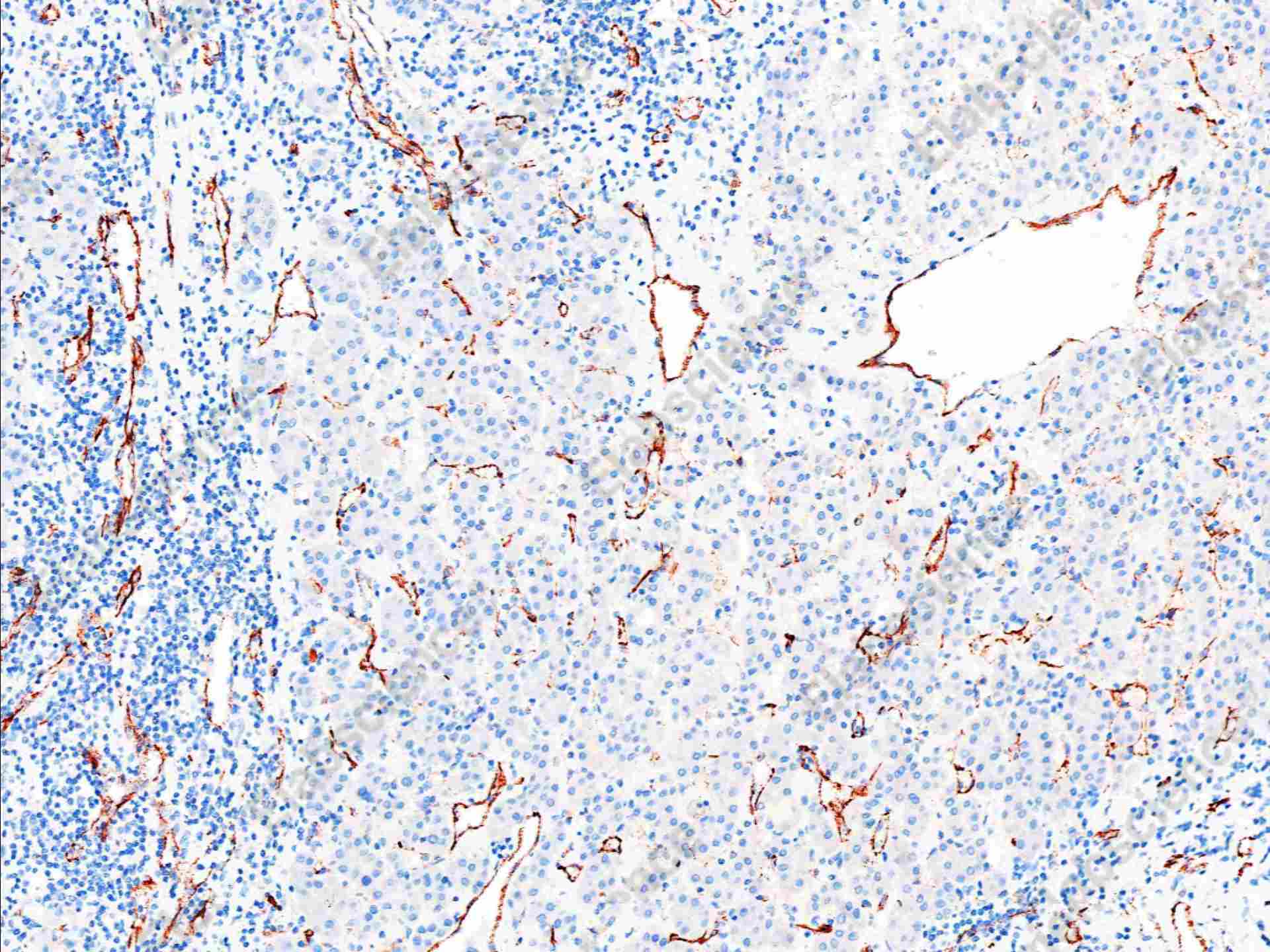 Recombinant CD31 Monoclonal Antibody - 1