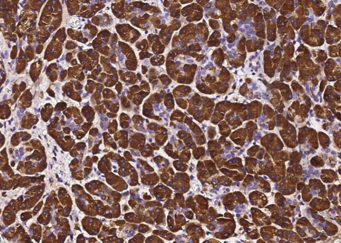 Recombinant PNLIP Monoclonal Antibody - small - 1