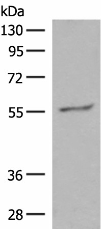 Western blot analysis of Hela cell lysate  using GPR161 Polyclonal Antibody at dilution of 1:500