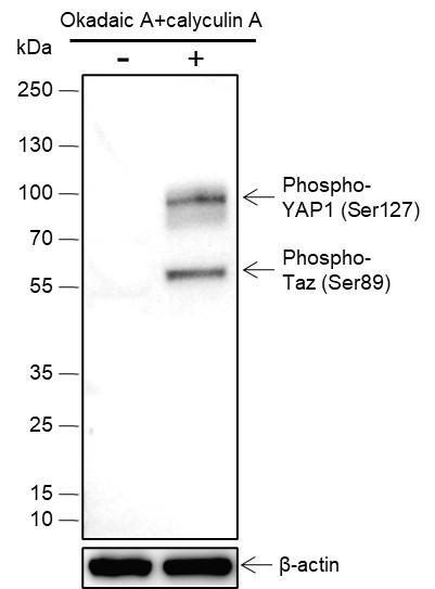Recombinant Phospho-YAP1 (Ser127) Monoclonal Antibody-searchlist-1