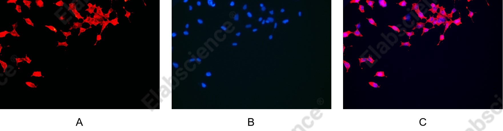 Recombinant α smooth muscle actin Monoclonal Antibody - 7