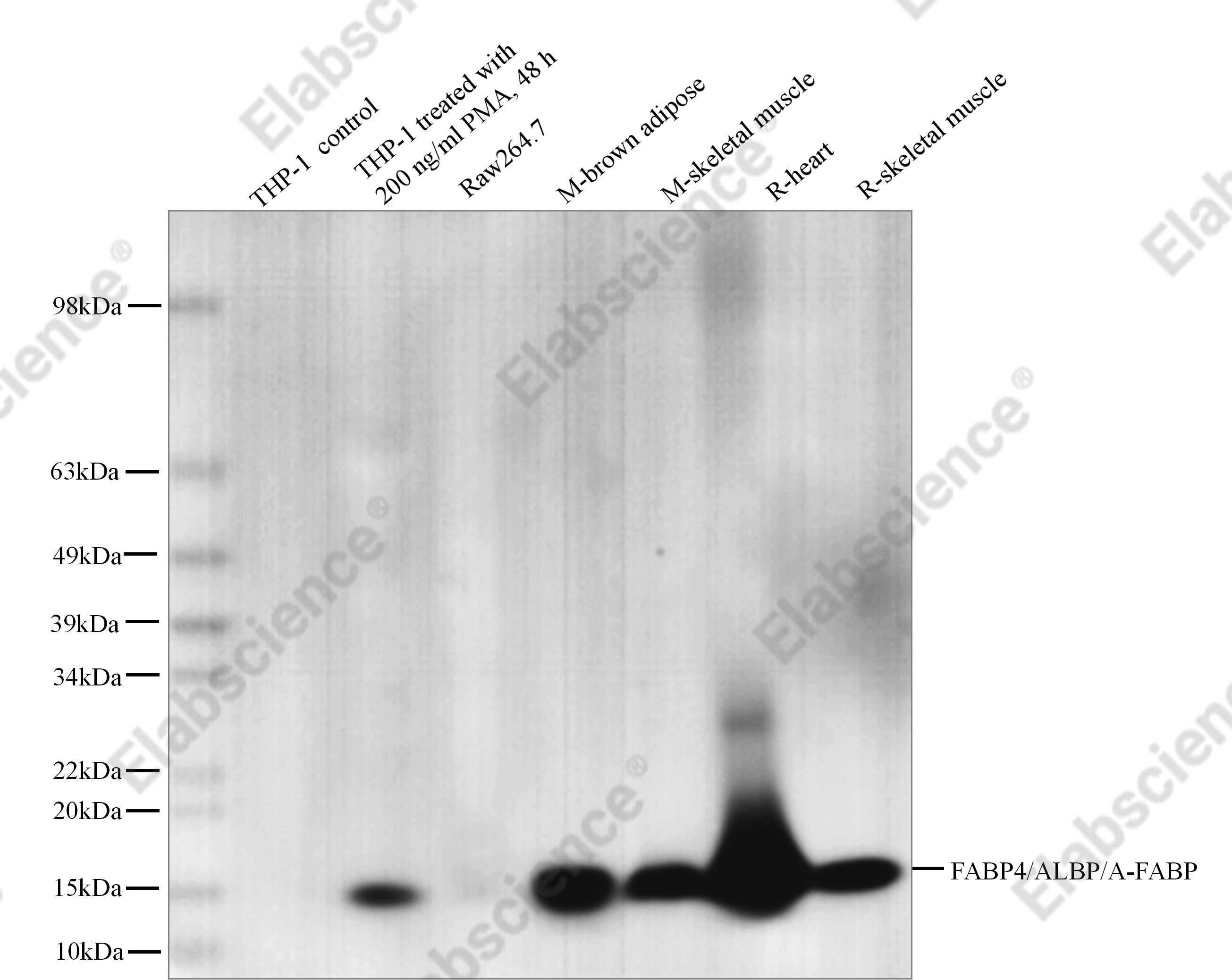 Recombinant FABP4/ALBP/A-FABP Monoclonal Antibody - 1