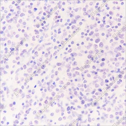 Recombinant SOX11 Monoclonal Antibody - 2