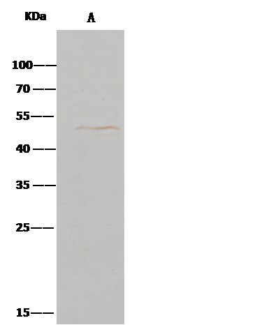 Recombinant ENTPD5 Monoclonal Antibody - small - 4