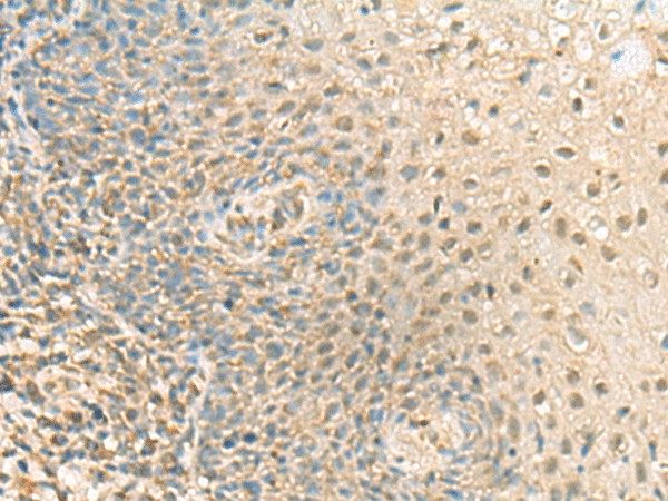 Immunohistochemistry of paraffin-embedded Human tonsil tissue  using PPCDC Polyclonal Antibody at dilution of 1:55(?200)