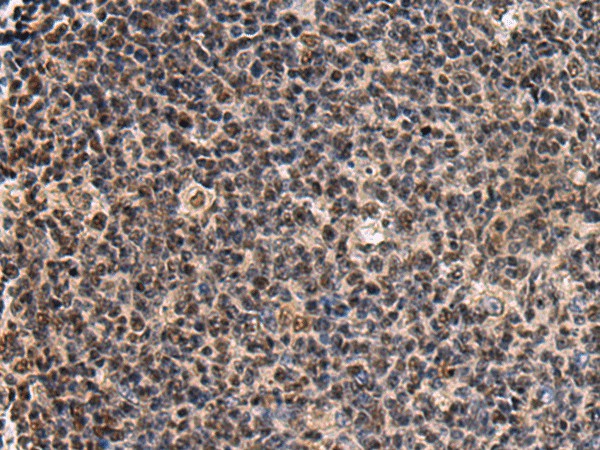 Immunohistochemistry of paraffin-embedded Human tonsil tissue  using SIK3 Polyclonal Antibody at dilution of 1:60(?200)