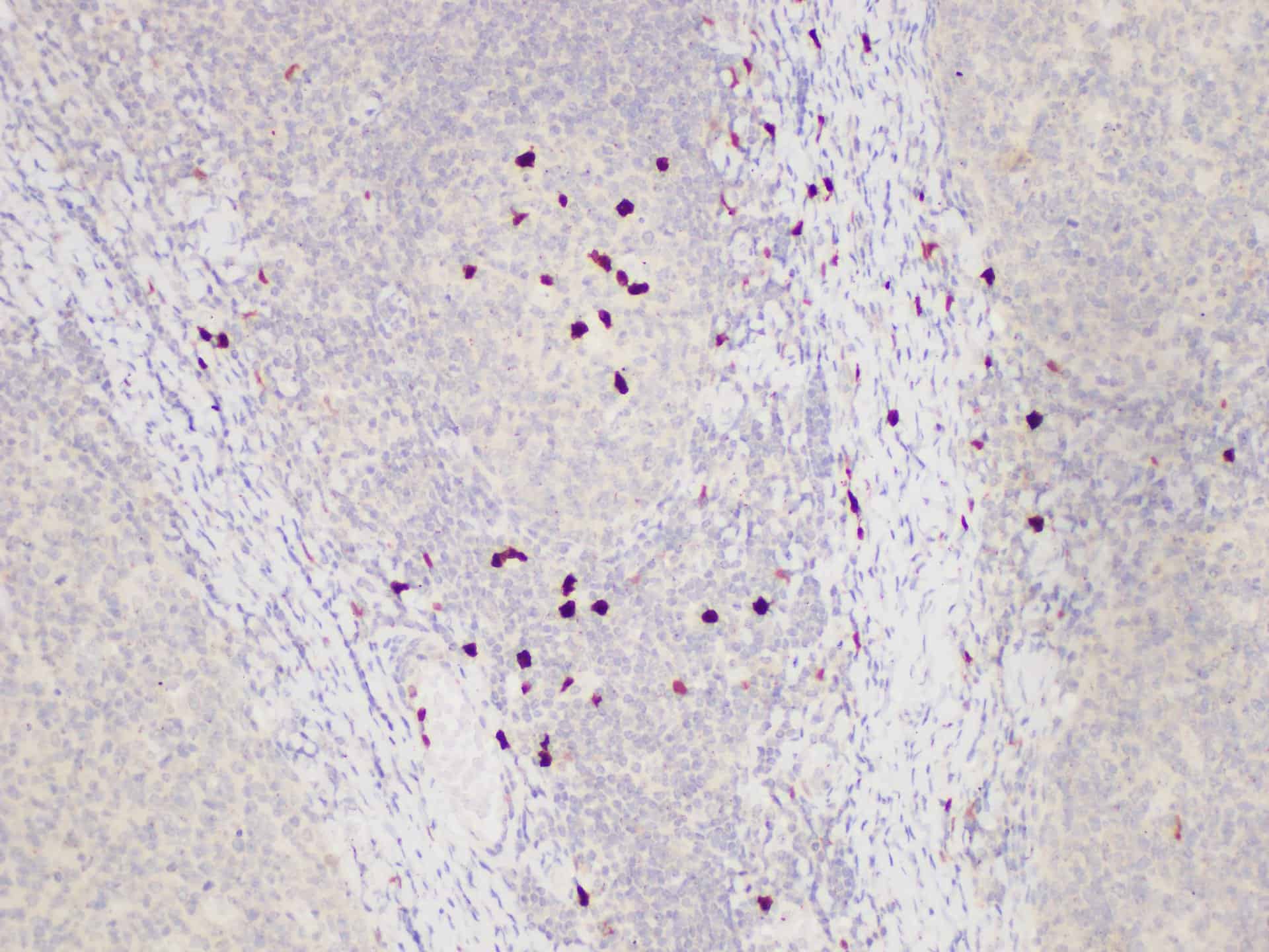PE Rat IgG2b, κ Isotype Control[LTF-2]-产品推荐-7