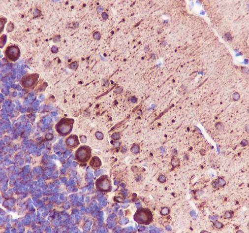 Recombinant beta III Tubulin Monoclonal Antibody - small - 4