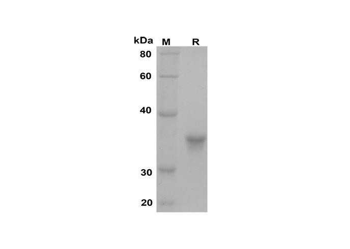 Recombinant Mouse IL-33 Protein(Trx Tag)-1
