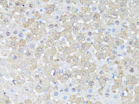 Immunohistochemistry of paraffin-embedded Mouse liver using mTOR Polyclonal Antibody at dilution of 1:150 (40x lens).