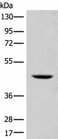 Western blot analysis of 293T cell lysate  using SHPK Polyclonal Antibody at dilution of 1:500