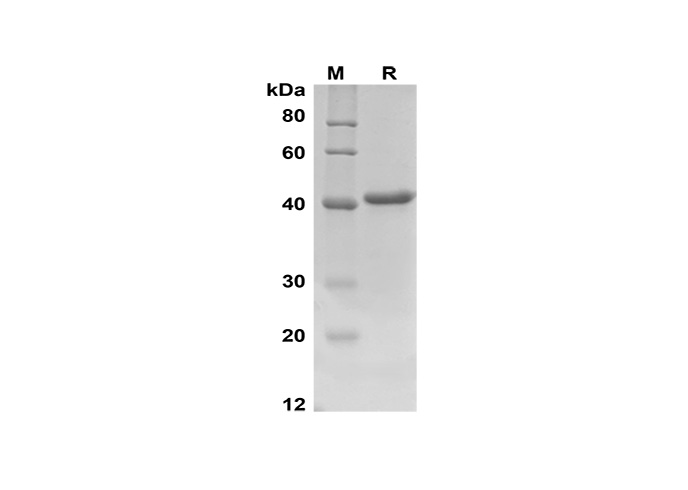 Recombinant Rat IL7R/IL-7R/CD127 Protein(His Tag)-产品推荐-1