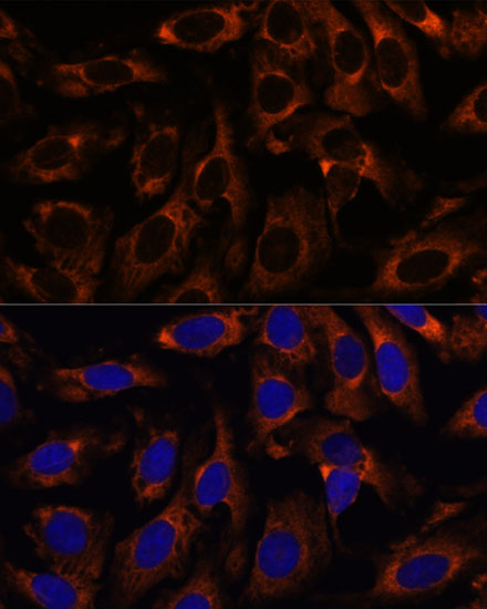 Immunofluorescence analysis of U-2 OS cells using CCT3 Polyclonal Antibody at dilution of 1:100. Blue: DAPI for nuclear staining.