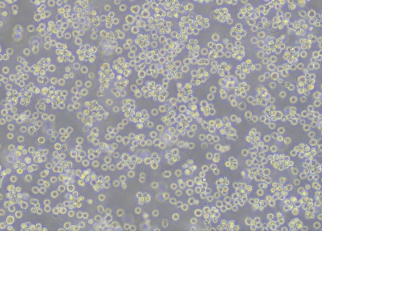 REC-1 Cell Complete Medium - 6