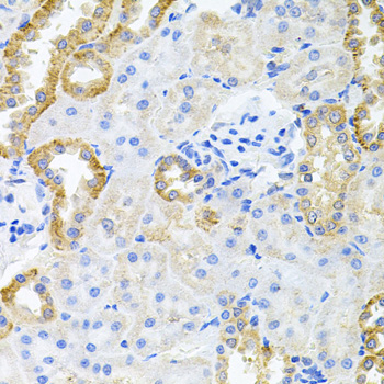 Immunohistochemistry of paraffin-embedded Rat kidney using STRN3 Polyclonal Antibody at dilution of  1:100 (40x lens).