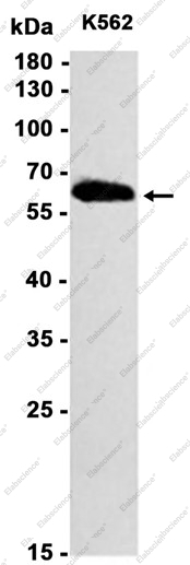 Recombinant PFKFB3 Monoclonal Antibody - 2