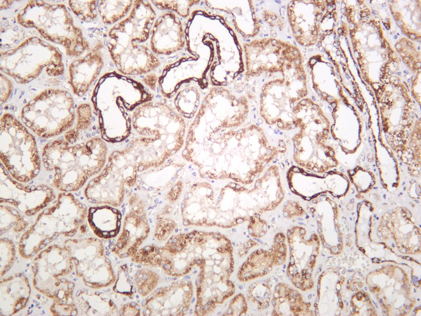 Recombinant SOD2 Monoclonal Antibody - small - 4