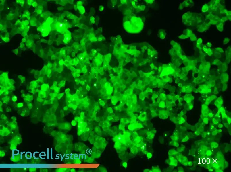 MCF-7-GFP Cell Complete Medium - 2