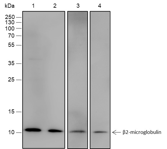 Recombinant beta-2-Microglobulin Monoclonal Antibody-searchlist-1