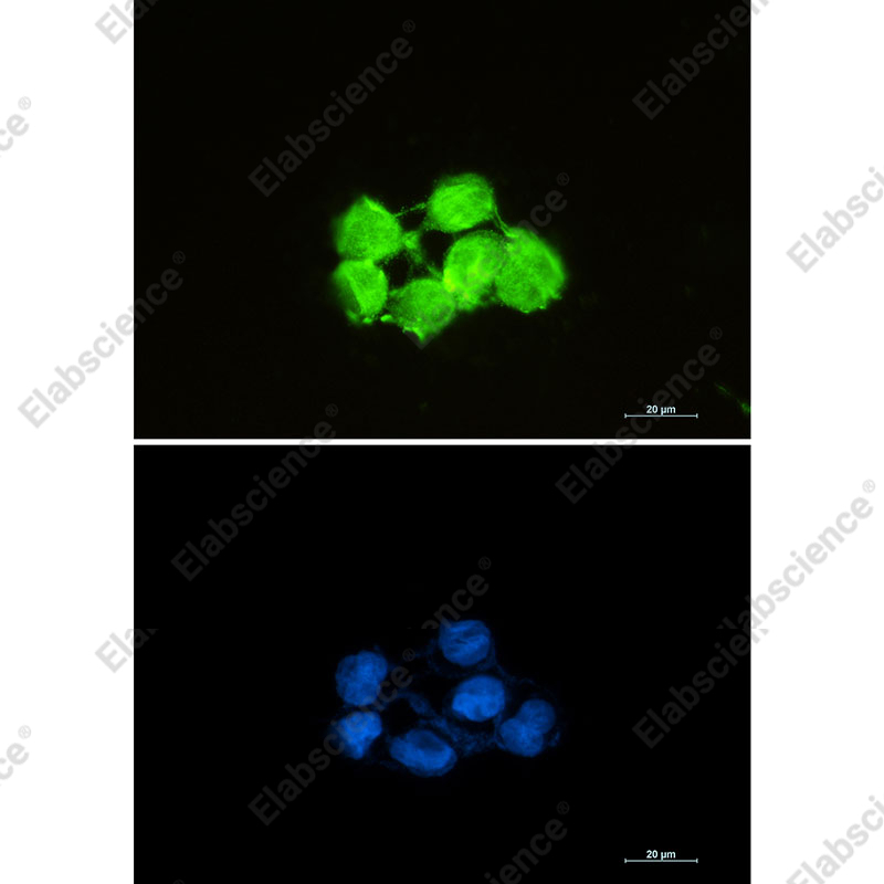 Recombinant SOD1/Superoxide Dismutase Monoclonal Antibody - 3