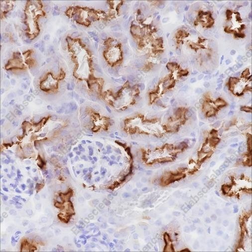Recombinant CD15/SSEA1 Monoclonal Antibody - 3